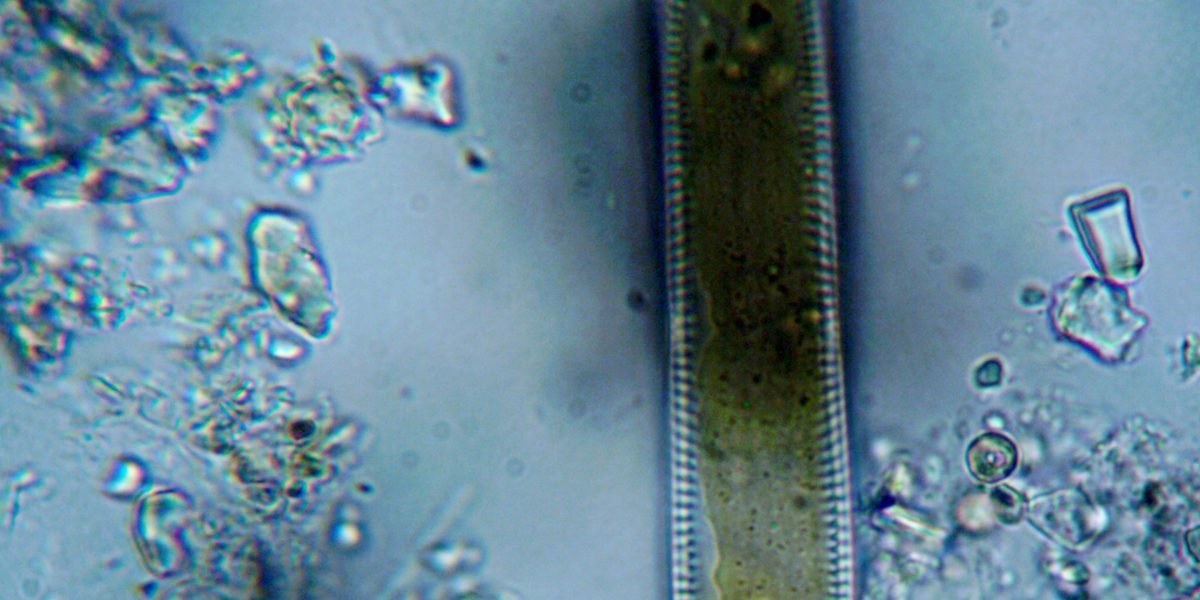 Microscope image of phytoplankton groups